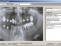 Добавление рентгеновского снимка в базу данных DentExpert
